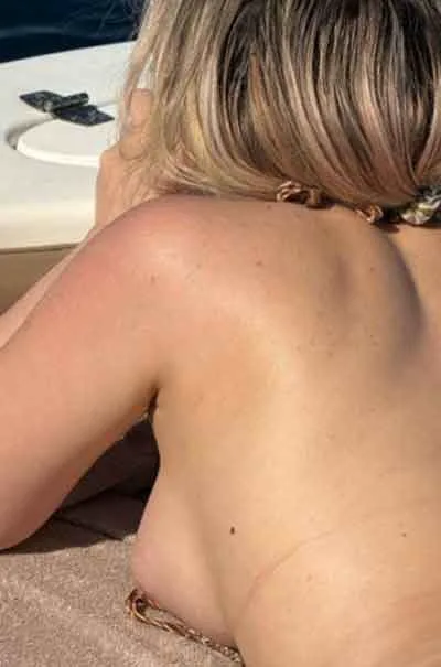 Linnea, 30 år